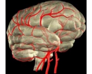 Blood clots in the brain